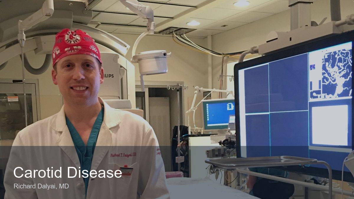 Carotid disease video thumbnail